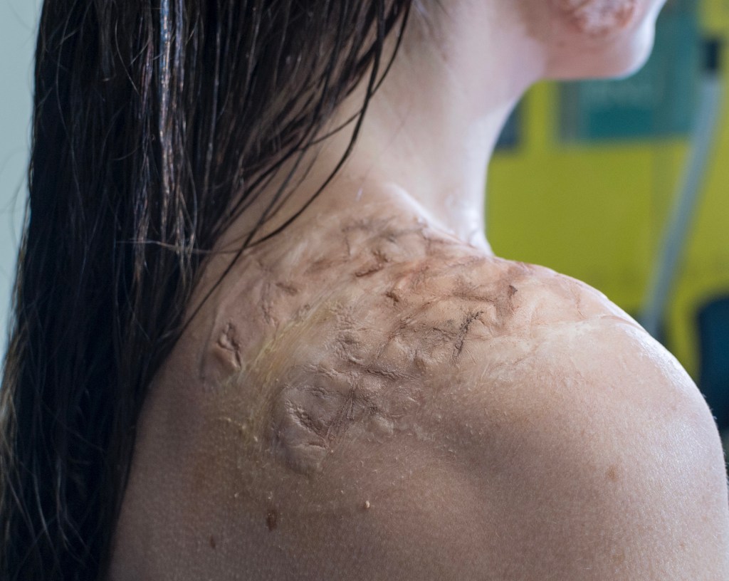 Prosthetic makeup and hair styling